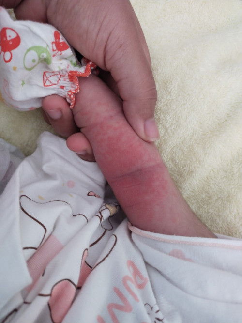 แบบนี้คือน้อแพ้หรือเปล่าค่ะ