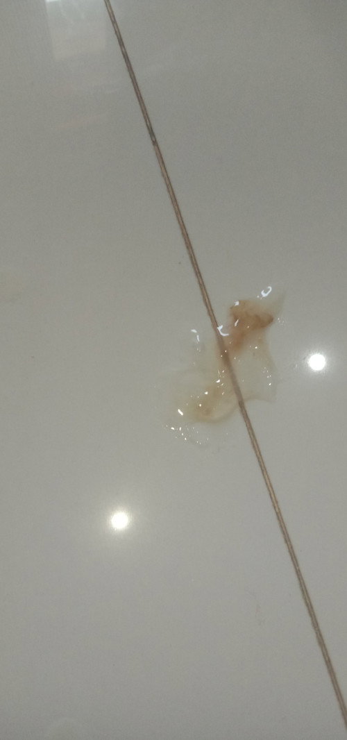 Lendir bercampur darah