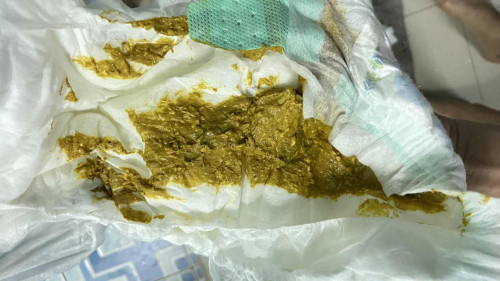 ถ่ายแบบนี้ปดติมั้ยค่ะ