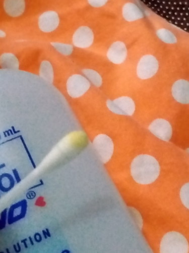 Pusod may amoy (8days old baby)