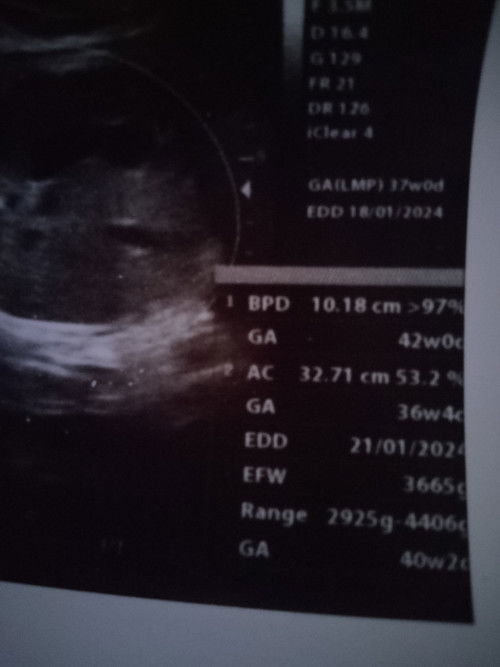 Menanyakan hasil usg
