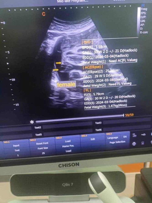 สอบถามแม่ๆคะ