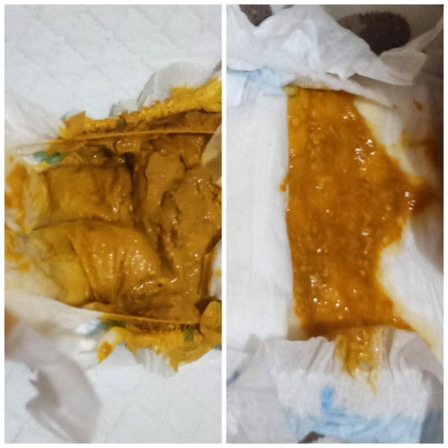 bayi 2 bulan kurang 2 hari bab 2x sehari, yg subuh normal tp yg malam cair berampas