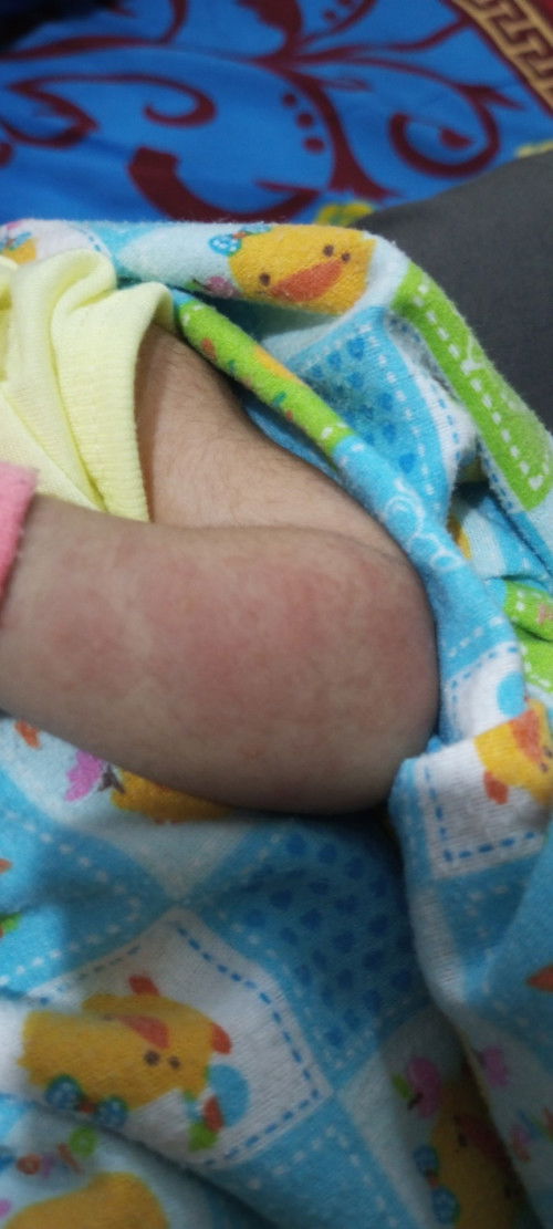 Mom ada yg tau gk ya ini knp..gimana cara ngobatin nya