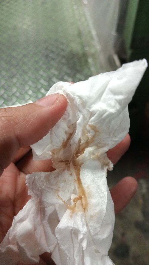 flek di 7 minggu kehamilan