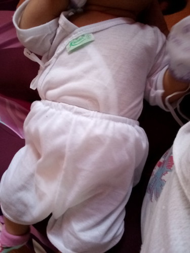 barubaruan at 6 weeks ?