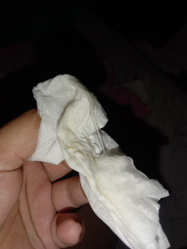 Ano po kaya itong discharge ko na parang sipon??andami po maghapon na lumabas sakin kahapon Hanggang