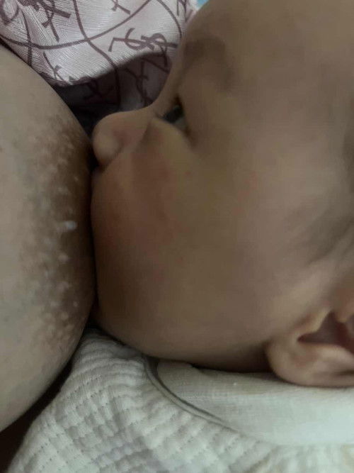 Sữa chảy ra từ ngực (ko phải núm) có bình thường ko?