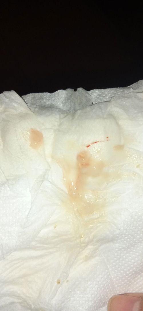 Normal or not Normal