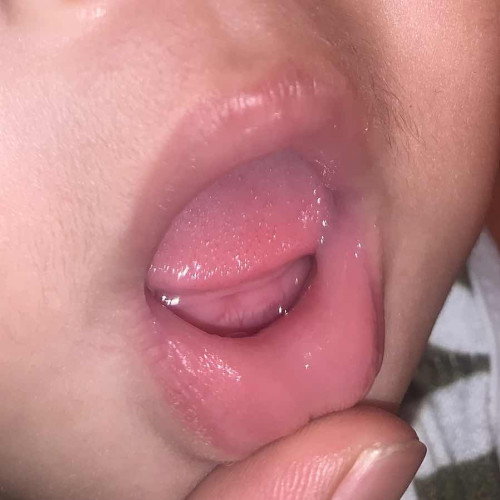 Apakah ini tumgi