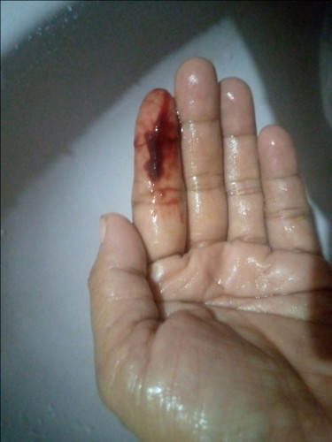 ใครเคยเป็นแบบนี้มั้ยค่ะ
