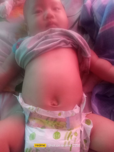 normal po ba mga size ng tyan ng baby ito