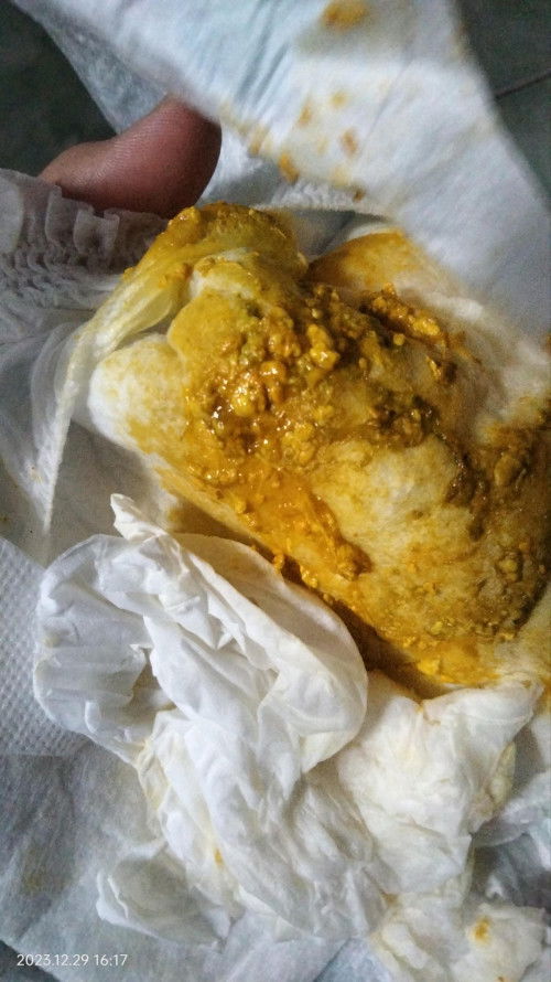 bunda" mau brtanya. fases bayi 1 bulan 20hri kya gni wjar g ya?soalnya ank sya lg batuk jg.