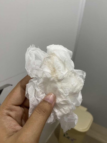 36 week มีคล้ายเลือดสีน้ำตาลออก มีปวดท้องเหมือนปวด ปจด สลับ ปวดอึ คืออาการอะไรค่ะ