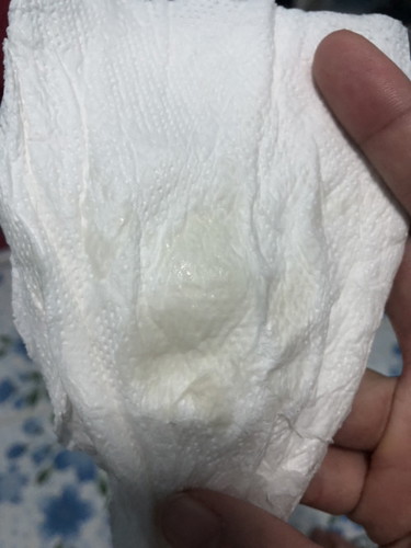 น้ำคร่ำรั่ว หรือว่าตกขาวคะ