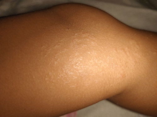 Kaki anak usia 4thun