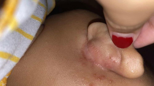 ada yg tau ini anak aku knp ya? tolongg share yg prnh ngalamin🙏