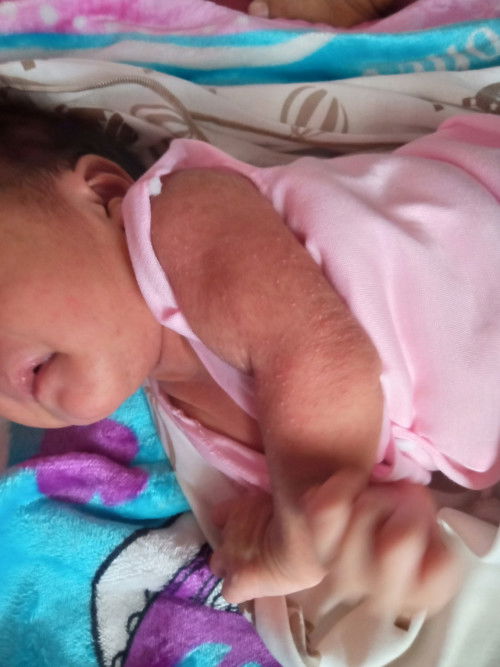 bun kulit bayiku seperti ini knp ya?