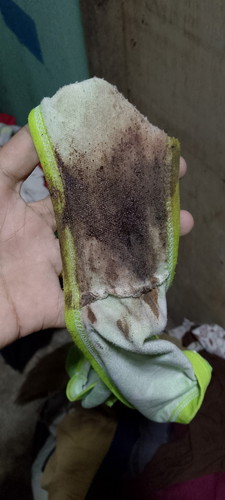 Tanong kolang po normal poba tong lumabas sakin Ngayon lng po Yan in Mag 2months palang ako pregnant