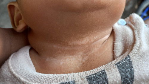 Putih² seperti panu