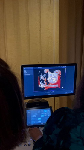 Will the baby's nose look exactly the same as this 3d ultrasound image?