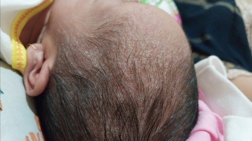 Usia bayi 7 hari