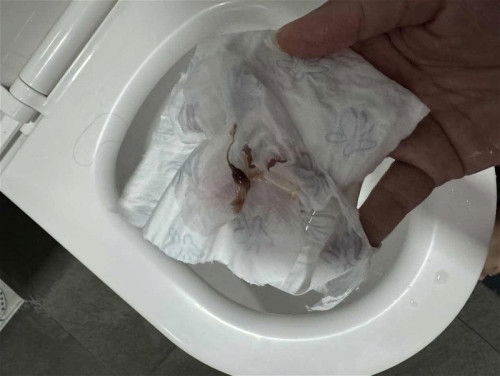 Brown discharge with mild backache - 27 weeks 3 days