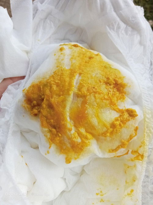 Feses bayi 2 bulan 25 hari