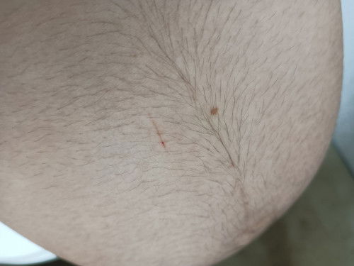 อยากทราบคะ
แม่ๆท้องคนไหนเคยโดนแมวข่วนท้องบ้างคะ จะเป็นอะไรไหมคะ