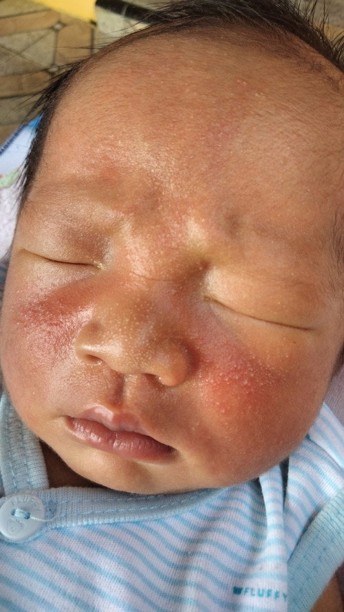 Bayi 8 hari