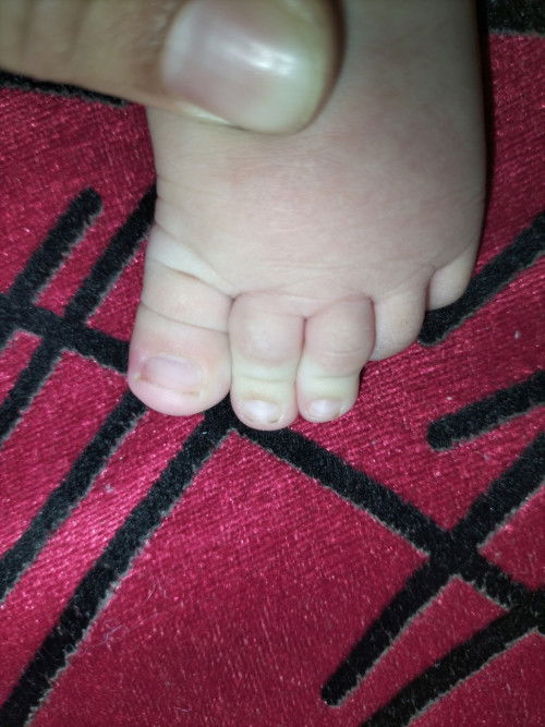 นิ้วโป้งเท้า