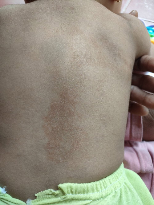 Kulit bayi