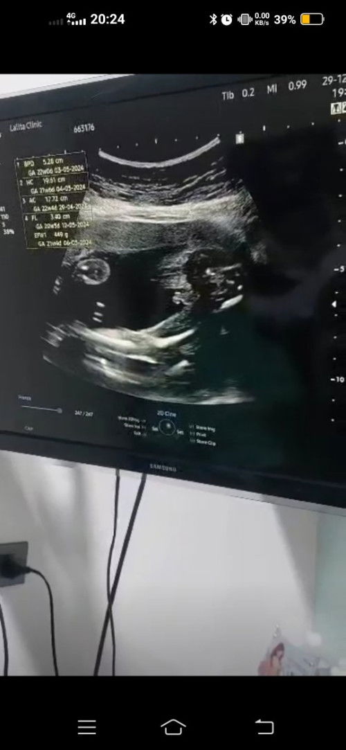 เดาเพศลูกน้อย