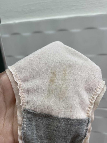 7 weeks spotting ke?
