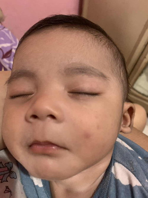 Barangkali bunda ada yg tau bisa dijawab bekas muka diankku