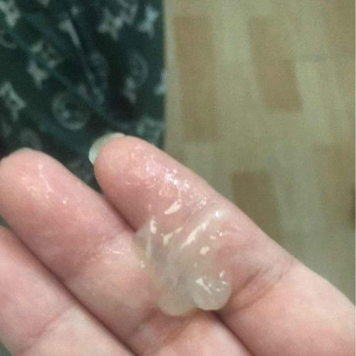 สอบถามแม่ๆผู้รู้หน่อยค่ะ
ขออภัยในภาพน่าเกลียด