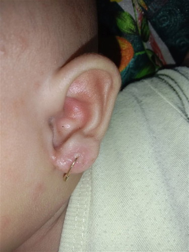 telinga berair
bantu sharing ya bund. lubang anting nya berair. kira2 kasih obat apa ya bun ??