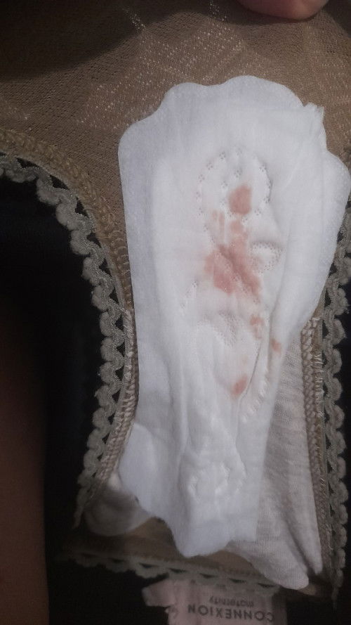 FLEK SAAT HAMIL 5BULAN