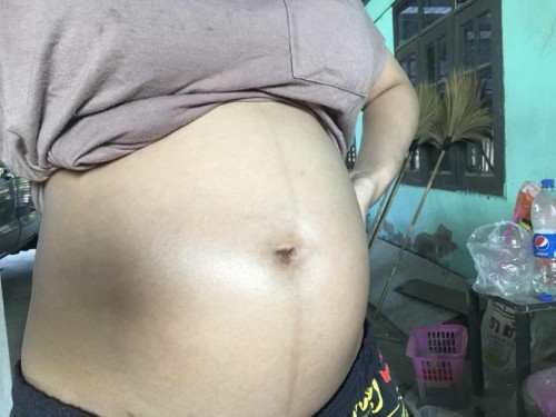 7 เดือน ท้องเล็กไมค่ะแม่ๆ คุณแม่ 7 เดือนท้องใหญ่แค่ไหนกันบางค่ะ