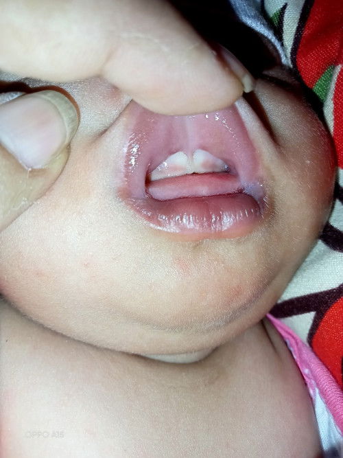 Mommies may liptie ba c baby ??   

  Thank you in advance sa mga sagot ☺️