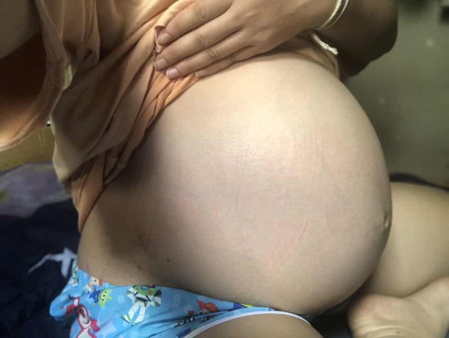 35w มีแต่คนทักว่าท้องใหญ่มาก