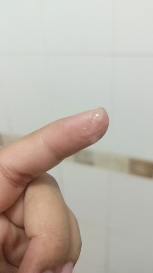 แบบนี้ใช่อาการใกล้คลอดรึป่าวค่ะต้องไปหาหมอมั้ยท้องแข็งบ่อยแต่ไม่ปวดหรือเจ็บท้อง