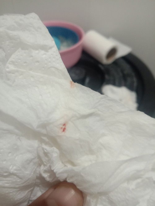 มีตกขาวเยอะไปหาหมอได้ยาสอดมา แล้วมีเลือดออก