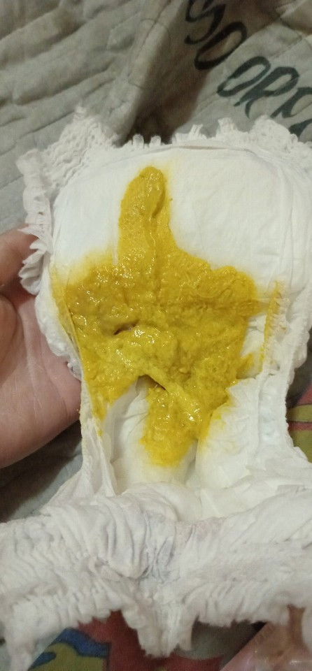 น้อง3เดือนอึแบบนี้ปกติมั้ยคะ