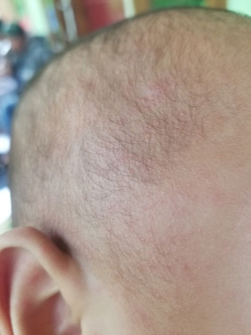 Ini knpa ya bund merah merah gt g tega