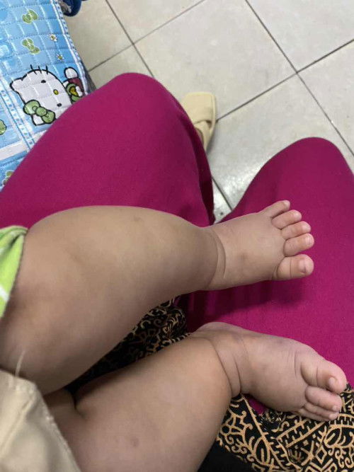 Kaki bayi jalan 5bulan seperti ini