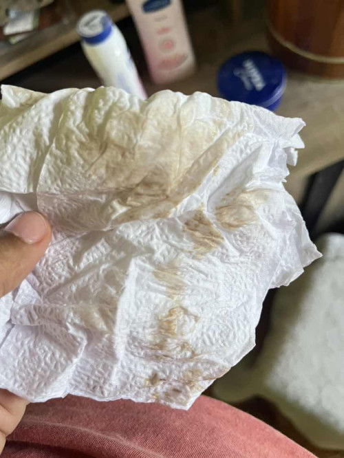 สอบถามแม่ๆหน่อยคะ