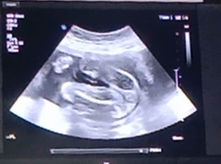 แม่ๆช่วยดูเพศให้หน่อยนะคะ