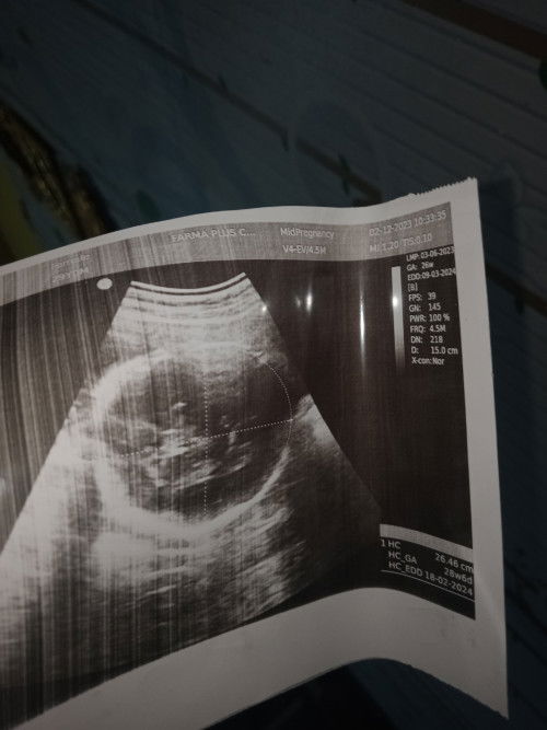 Mau nanya nih bund ??