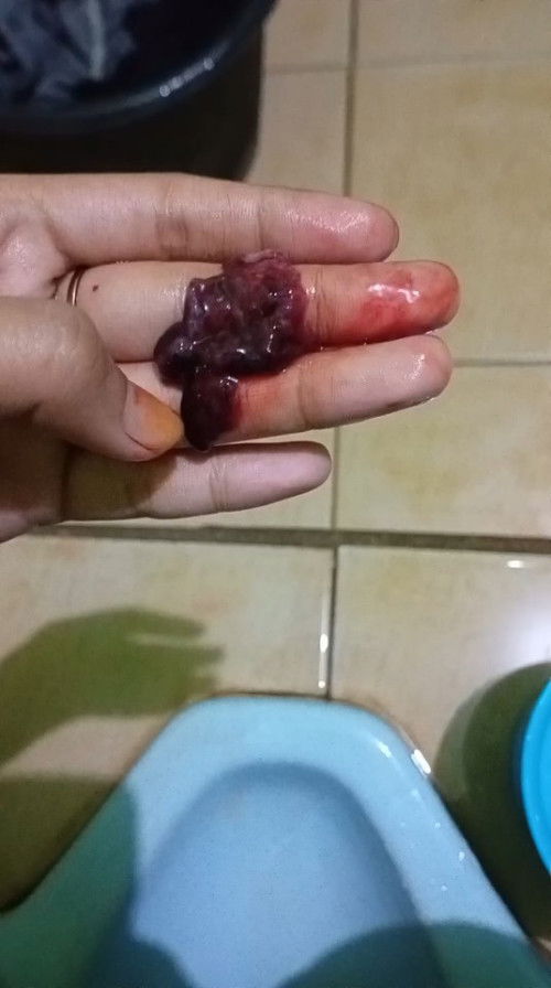 apakah ini keguguran/telat menstruasi?